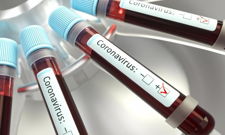 coronavirus, test positivo